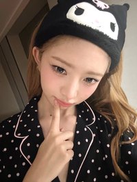 米发际线1米7