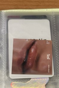 嘴唇卡