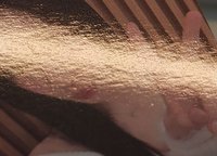 一週年露（有多處不明顯凹痕但肉眼還是看得見