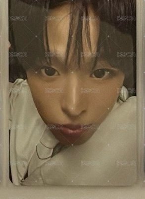 otl ms