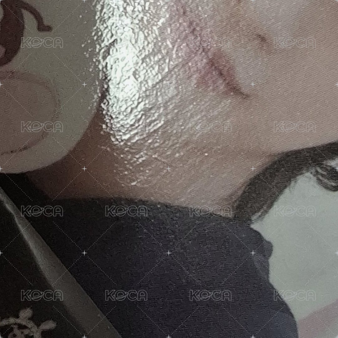 ➡️（有損）