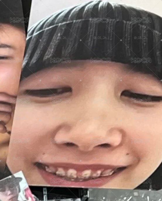 大臉路易