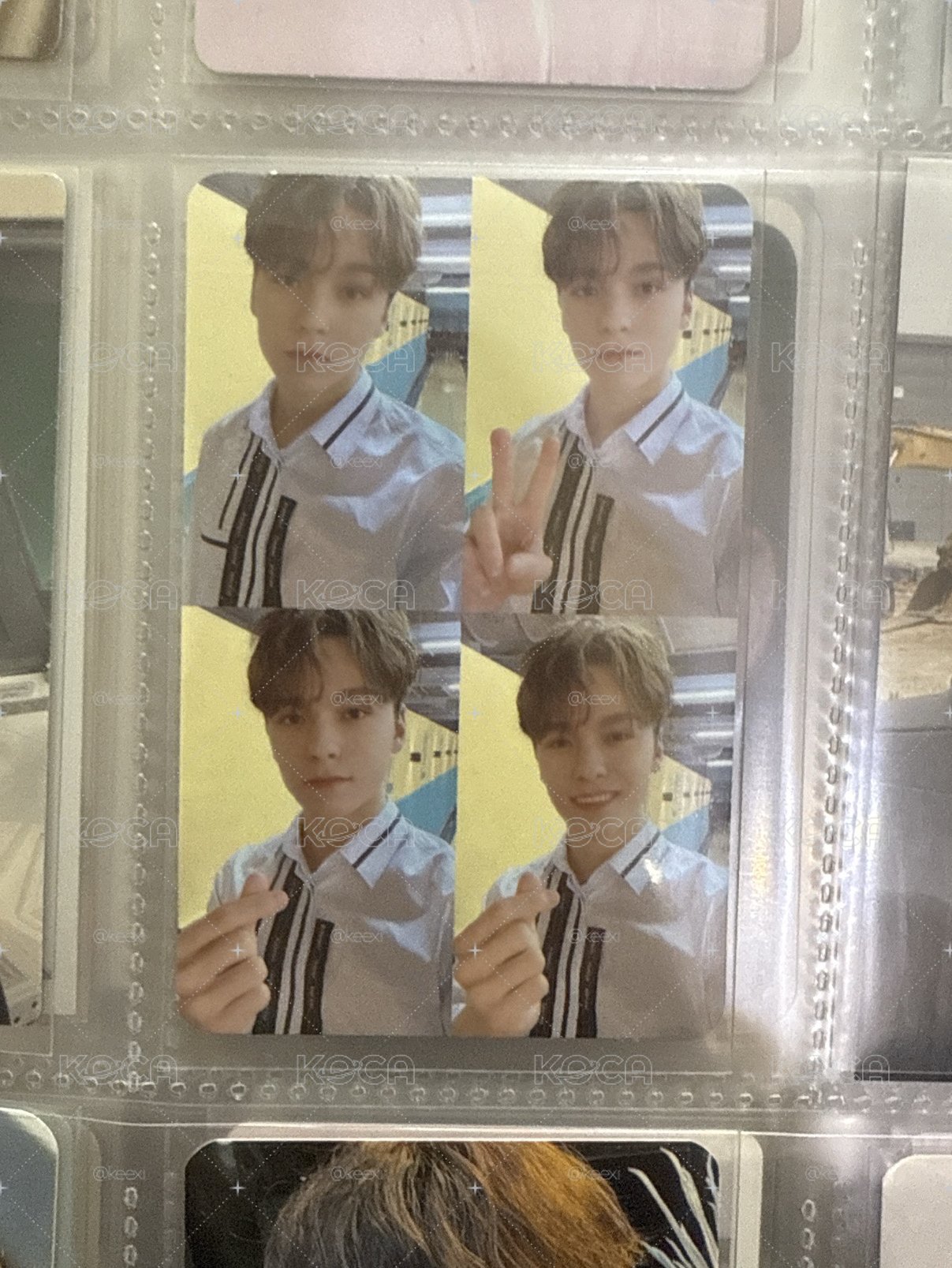 SVT 率
