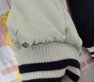 袖口手臂大損 收來無下水