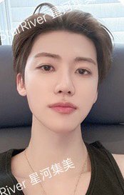 正規四 sr 1.0 A ver. 簽售卡 