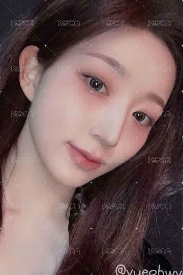 FORWARD am 5.0 簽售卡 阿卡貝拉 正面